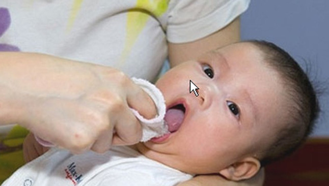 Mật ong trị tưa lưỡi cho bé