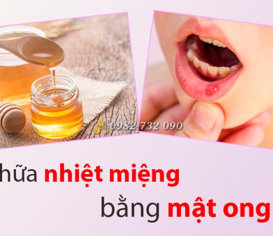 Phương pháp chữa nhiệt miệng cấp tốc